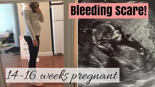 1416 weeks pregnant BLEEDING SCARE SCH [upl. by Tiat]