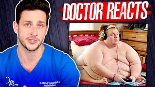 The Harsh Reality Of Being 800 Pounds  Doctor Reacts [upl. by Naitsabes314]