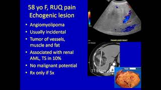 Liver Lesions [upl. by Munn]