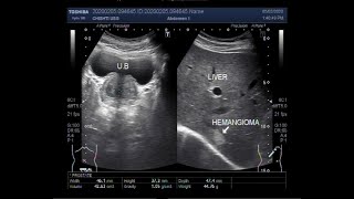 Introduction to Multiphase CT amp MRI of the Liver [upl. by Yerak]