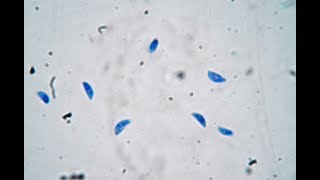 Toxoplasma gondii  live trophozoites [upl. by Kciregor]