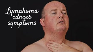 LYMPHOMA CANCER SYMPTOMS [upl. by Gaiser]