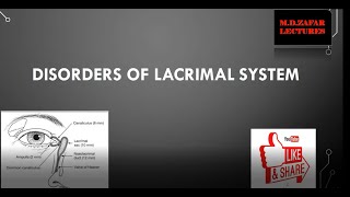 Lacrimal System Disorders [upl. by Gabriell]