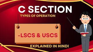 LSCS AND USCS  C SECTION  IN HINDI EXPLAINED  OBG  INC  RUHS  PART 4 BSC NURSING reninonline [upl. by Yarb133]