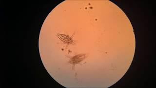 Zooplankton in the Microscope [upl. by Elleynad]