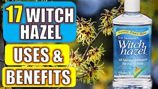 17 Surprising Witch Hazel Benefits amp Uses HEALTH  BEAUTY  CLEANING [upl. by Nolyar]