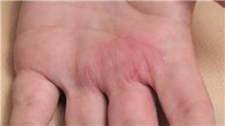 Dermatology Treatments  How to Diagnose Skin Rashes [upl. by Elletsirhc]