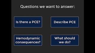 Pericardial effusions and tamponade basic POCUS evaluation [upl. by Lowry685]