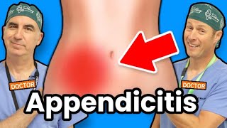 Appendicitis  How Do I Know If I Have Appendicitis [upl. by Yeldarb]