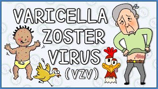 Varicella zoster virus Chicken Pox and Shingles herpes zoster [upl. by Princess82]