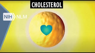 I Have High Cholesterol What Should I Do [upl. by Aneg162]