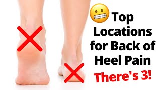 Back of The Heel Pain Locations [upl. by Nonnahsed]