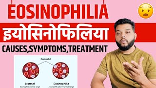 Eosinophilia Causes Symptoms amp Treatment In Hindi [upl. by Afrikah]