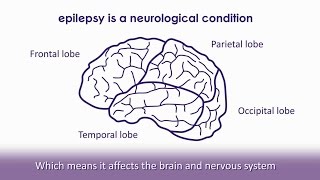 Temporal Lobe Epilepsy Basicsshort [upl. by Iohk]