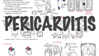 Pericarditis  Overview signs and symptoms pathophysiology diagnosis treatment [upl. by Naginnarb]