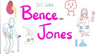 Bence Jones Proteins  Multiple Myeloma  Urine Test [upl. by Ahtaela257]