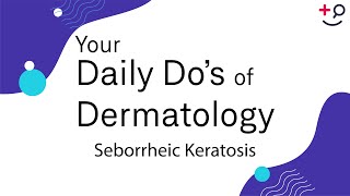 Seborrheic Keratosis  Daily Dos of Dermatology [upl. by Ocirederf804]