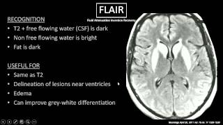 MRI Sequences [upl. by Tristan]