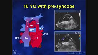 Systemic Vascular Resistance Total Peripheral Resistance  Cardiology [upl. by Elliven]