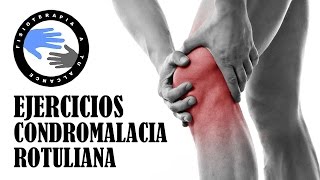 Ejercicios para condromalacia rotuliana o patelar [upl. by Llenel]