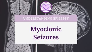 What are Myoclonic Seizures [upl. by Kearney]