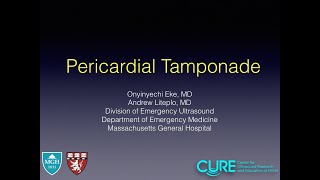 Pericardial Tamponade [upl. by O'Toole]