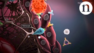 Osteoarthritis vs rheumatoid arthritis treatments  NCLEXRN  Khan Academy [upl. by Selokcin228]