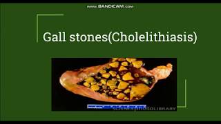 Cholelithiasis  Gallstones Pathogenesis amp Morphology [upl. by Enialehs481]