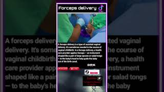 Forceps delivery [upl. by Eenafets]