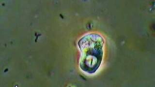 Active Amoeba Feeding [upl. by Keffer]