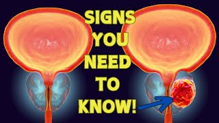 Prostate Cancer The Early Signs You Need to Know [upl. by Alistair]