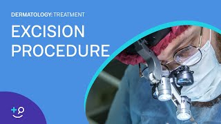 Excision Overview and Procedure Dermatology [upl. by Grochow536]