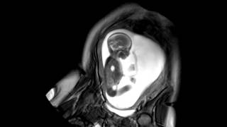 Foetal Development Unborn Baby Movement at 24 Weeks  WIRED [upl. by Eladnwahs]