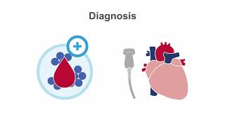 Endocarditis 101 Diagnosis and Treatment [upl. by Eeldarb]