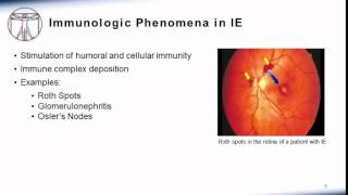 Endocarditis Clinical Manifestation [upl. by Acihsay]