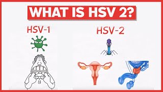 What is HSV 2 [upl. by Avat395]