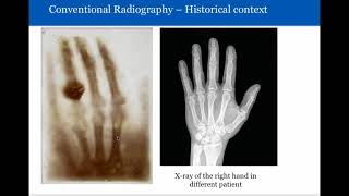 Introduction to Radiology Conventional Radiography [upl. by Alber]