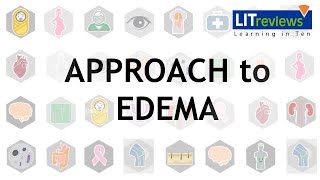 Approach To Edema [upl. by Laerdna452]