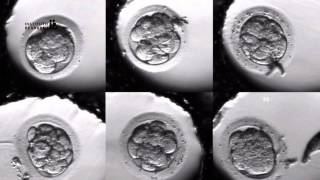 IVF PROCESS STEP BY STEP In Vitro Fertilisation Embryo cultivation [upl. by Tarrah775]