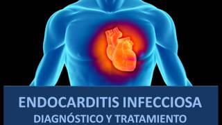 Endocarditis infecciosa  Diagnóstico y tratamiento [upl. by Musetta617]