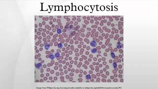 Lymphocytosis [upl. by Lenra313]