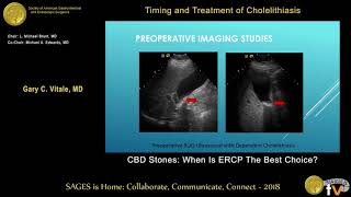 ERCP Practical Guide I Part 2 ERCP with Stone Extraction [upl. by Doherty]