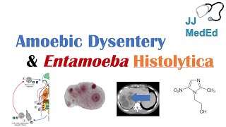 Amebiasis Amoebic Dysentery  Pathogenesis Clinical presentation Diagnosis amp Treatment [upl. by Xonk]