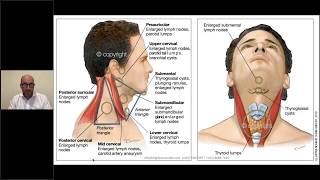 Neck lumps in general practice [upl. by Leif]