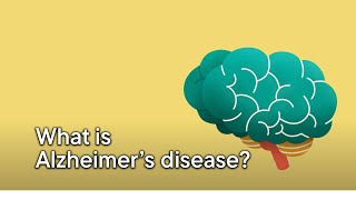 What is Alzheimers disease [upl. by Ahsilem]