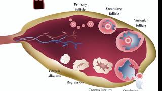 Ovarian Cysts [upl. by Nnaeed]