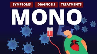 What is MONO Symptoms Diagnosis amp Treatments [upl. by Dupin]