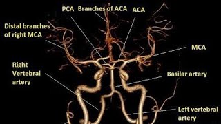 Basics of angiographic views PartII [upl. by Leodora122]