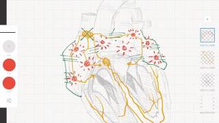 Cardiología y ECG Taquicardias supraventriculares vs ventriculares [upl. by Celine965]