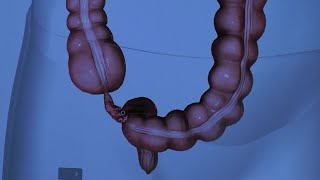 The Anatomy of the Appendix [upl. by Ahtenek]